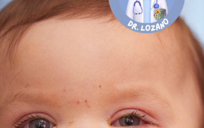 Ojos Rojos o Conjuntivitis Alérgica