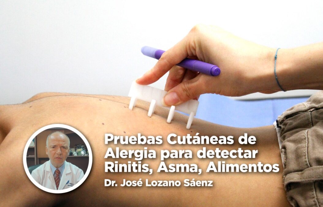 Pruebas Cutáneas de Alergia para detectar Rinitis, Asma, Alimentos – Dr. José Lozano Sáenz
