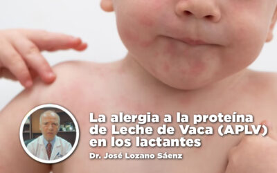 La alergia a la proteína de Leche de Vaca (APLV) en los lactantes – Dr. José Lozano Sáenz